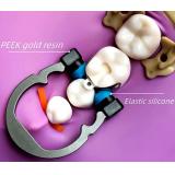 6pcs Dental Sectional Matrix Ring System Matrix Clip NITI Clamps Separating Ring