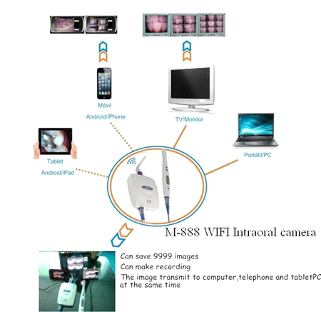 Dental Corded Intraoral Camera For Windows7 And IOS System